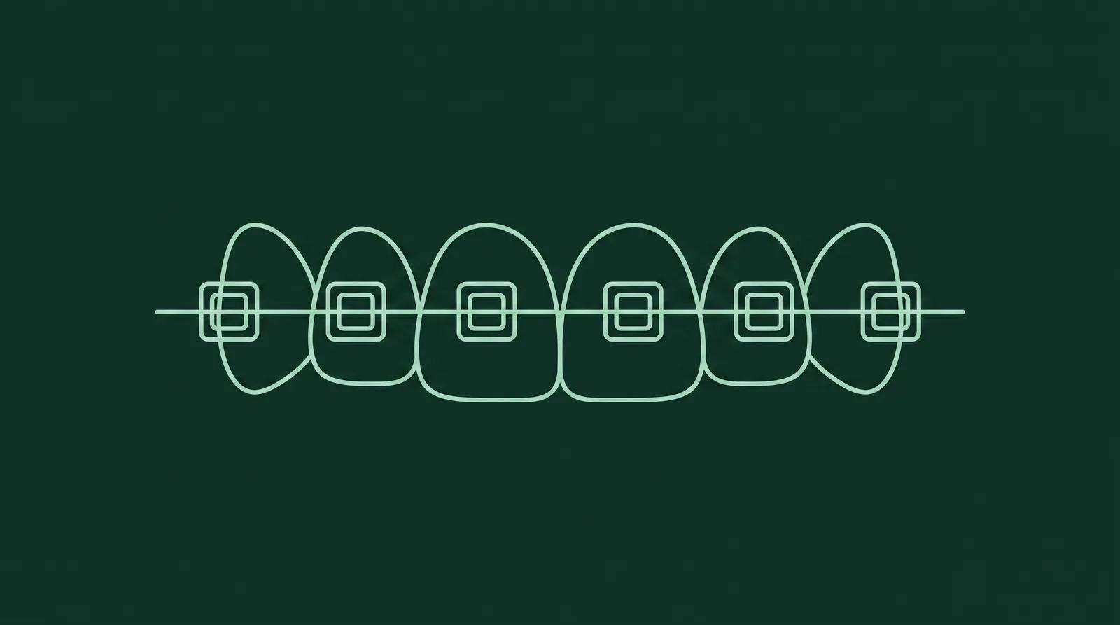 Schéma linéaire de dents antérieures avec attaches céramiques et arc